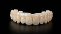 Immediate Full Arch Temp Denture